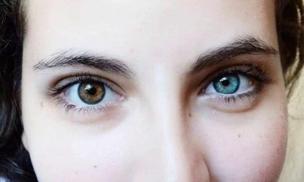 Olhos masculinos de cores diferentes