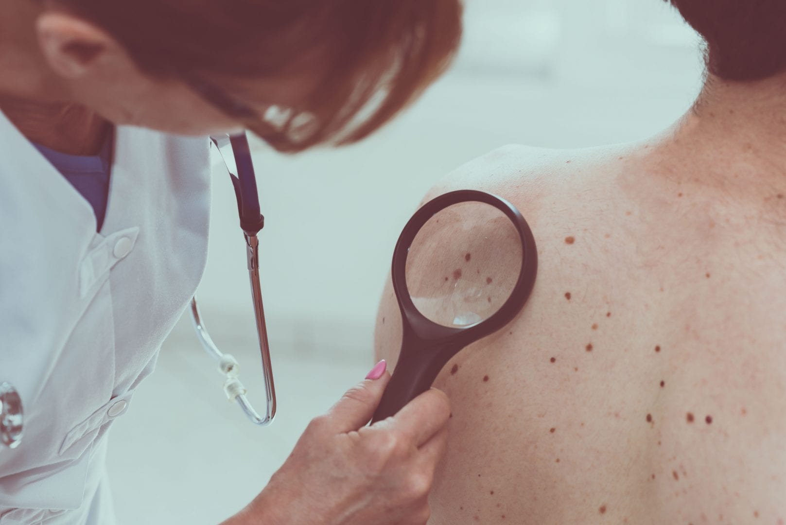 Fique atenta ao câncer de pele e saiba quando é hora de procurar um médico