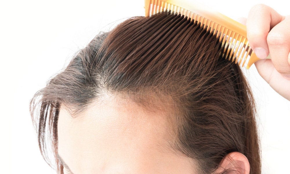 Queda de cabelo - quais são as causas, como evitar e como tratar