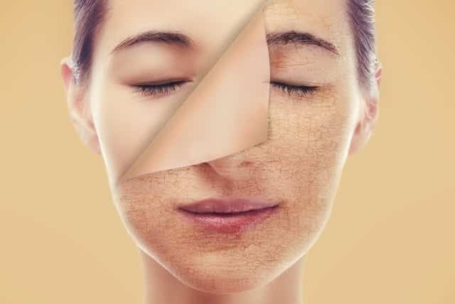Clarear a pele: 4 técnicas para clarear e 5 hábitos para mantê-la