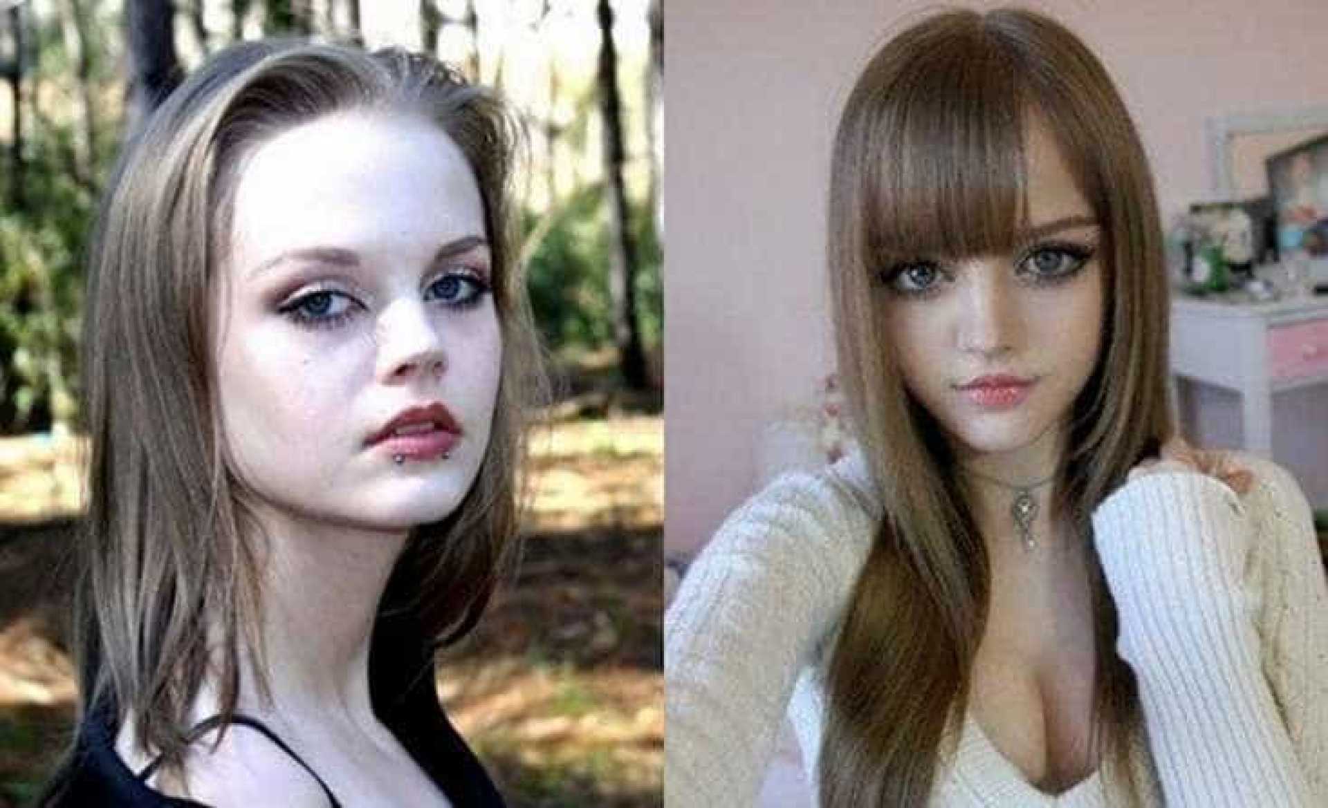 O antes e o depois de algumas barbies humanas [Top 5]