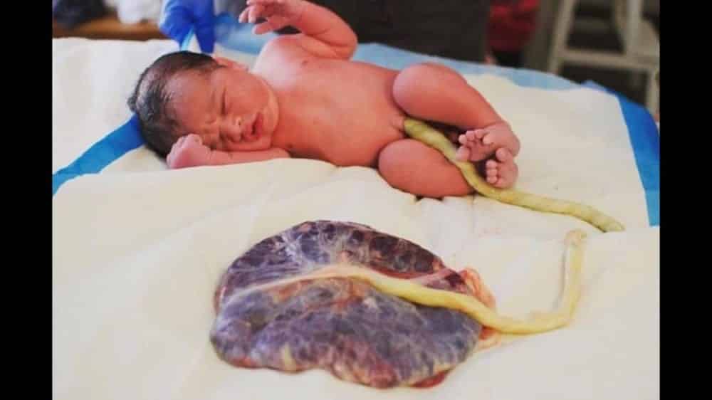 Entenda mais sobre as placenta e o que fazer com ela após o parto