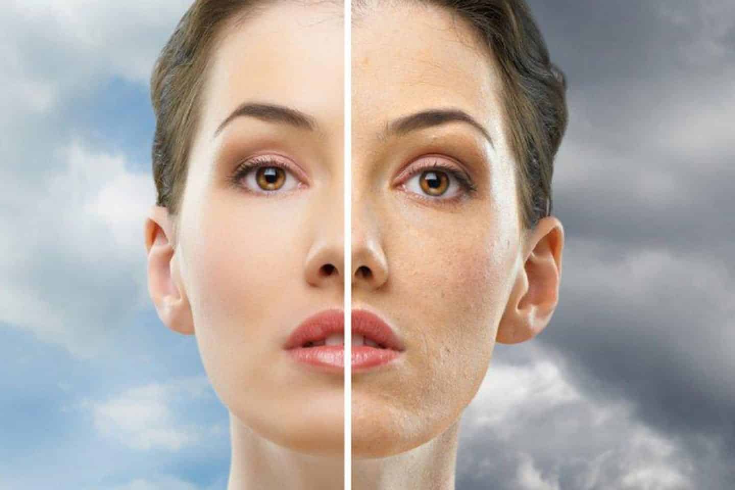 Niacinamida- Benefícios, o que é e qual sua importância para a pele