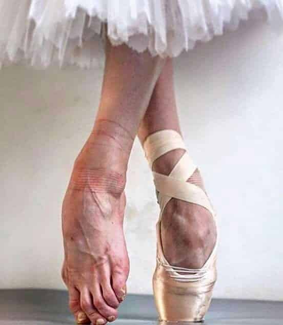 Confira a realidade dos pés de bailarina atrás do palco