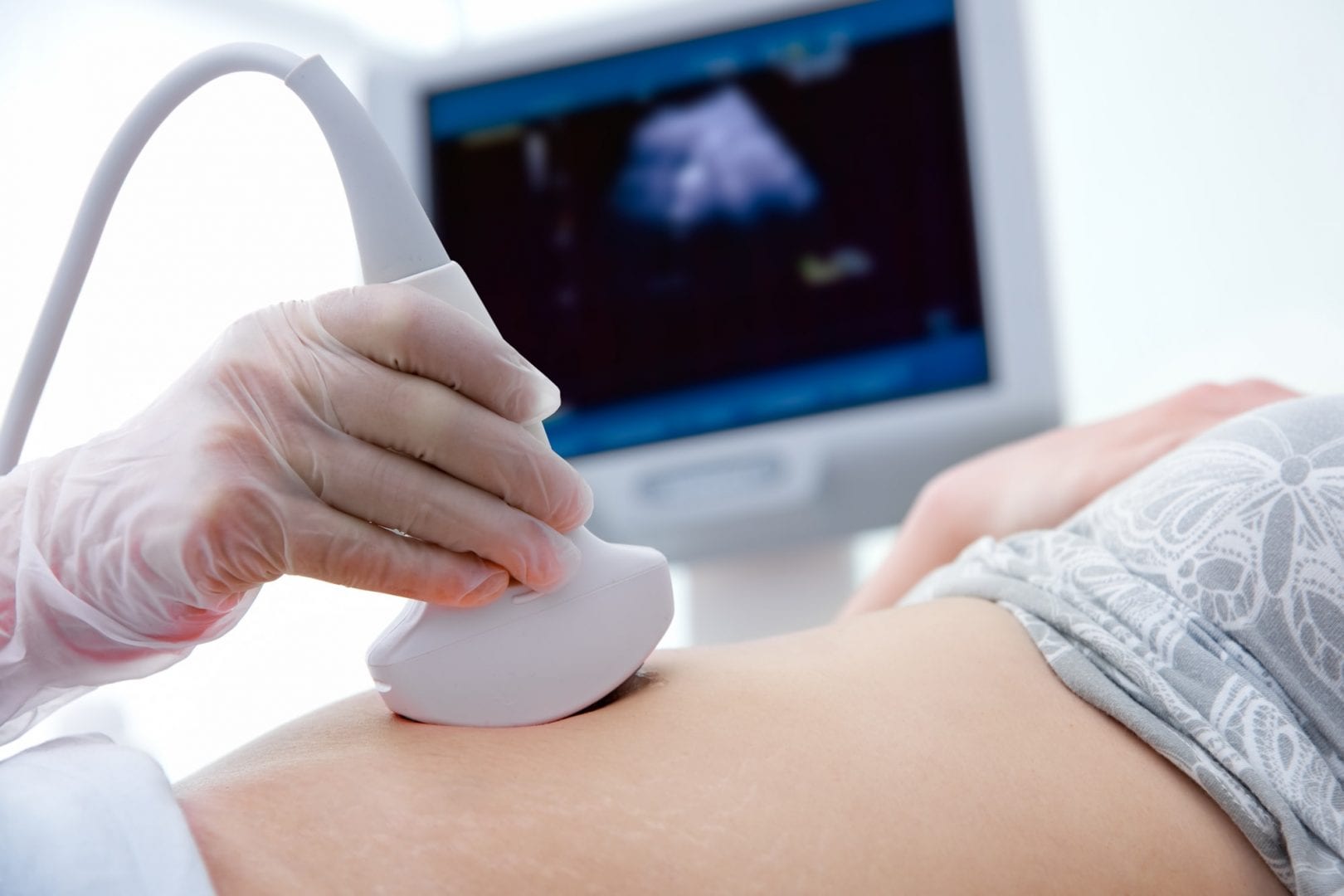 exame de gravidez de sangue como funciona? O que é Beta HCG?