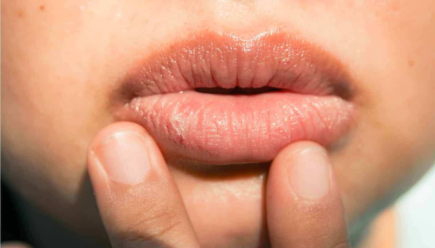 Lábios- Por que ressecam, sensibilidade, saúde dos lábios + dicas