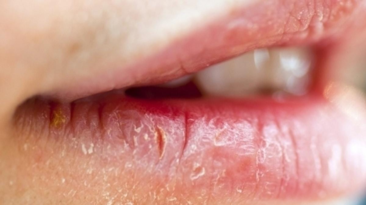 Lábios- Por que ressecam, sensibilidade, saúde dos lábios + dicas