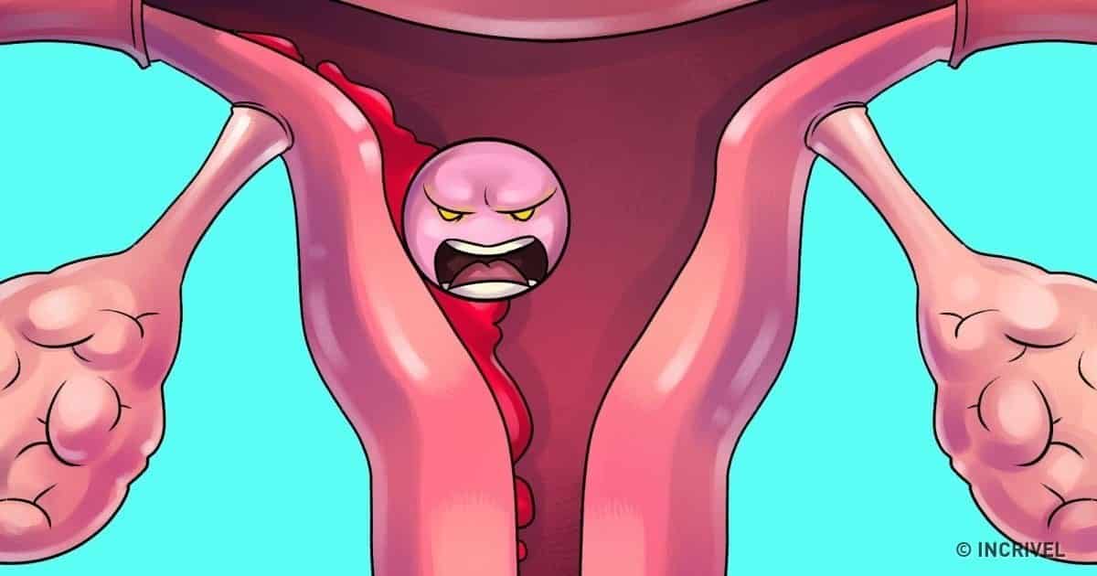 Massagem para cólica menstrual – O que é, opções e como fazer