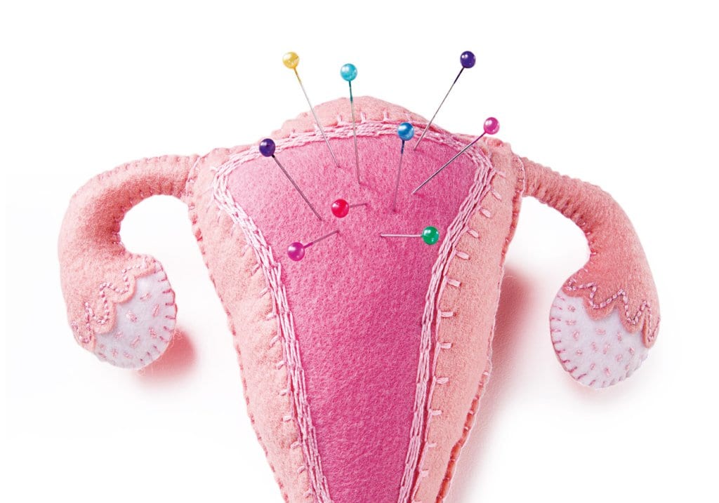 Cólica menstrual - o que é, porque acontecem e como aliviá-las