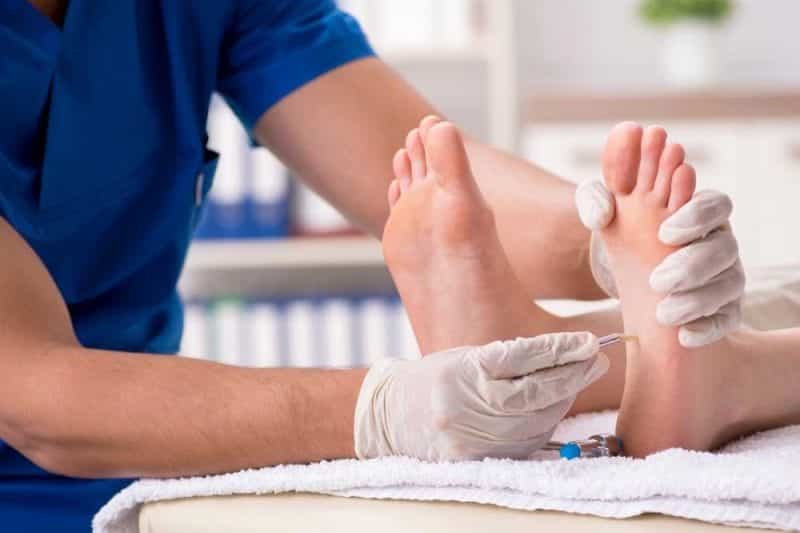 Calos nos pés - o que são, como prevenir e quais os tratamentos