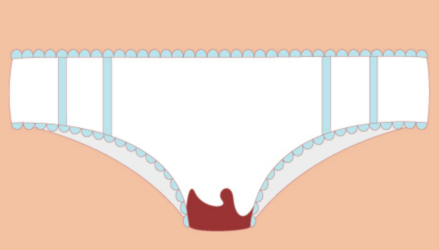 Menstruação em “borra de café”: existe relação com a fertilidade?