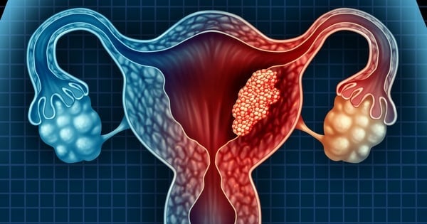 Coágulo na menstruação: o que são e 7 possíveis causas
