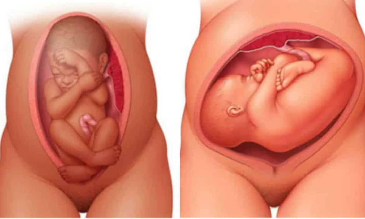 Colo do útero fechado: descubra o que é e para o que serve