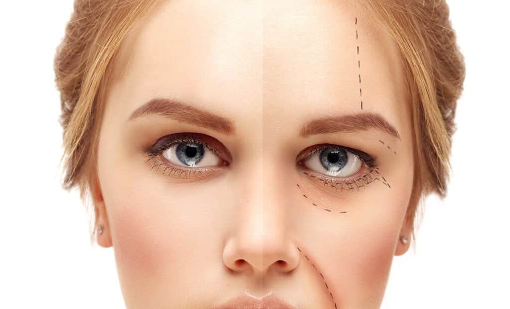9 Riscos do botox: complicações que a mídia não comenta